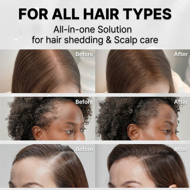 Scalp Serum with Massage Comb for Hair Growth