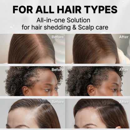 ✨ Nexzuva Scalp Massage Brush